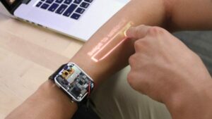 Smartwatch