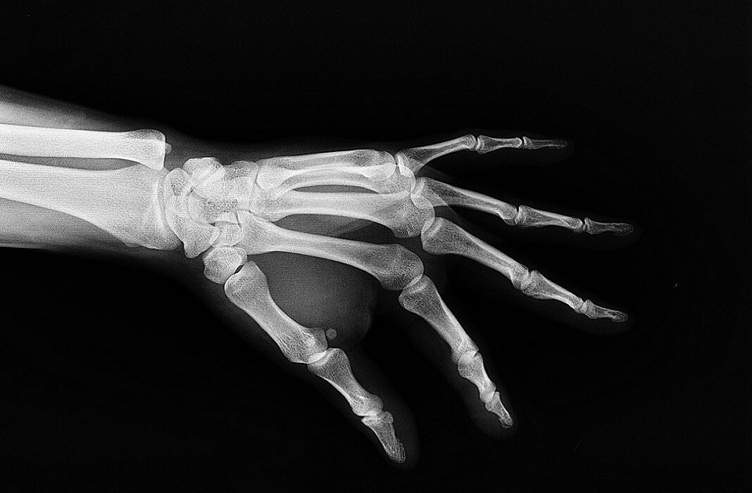3D