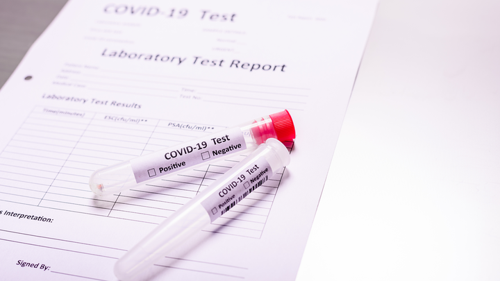 Έρευνα: Ο COVID-19 δεν μεταδίδεται μετά από 11 ημέρες 2 Έρευνα: Ο COVID-19 δεν μεταδίδεται μετά από 11 ημέρες