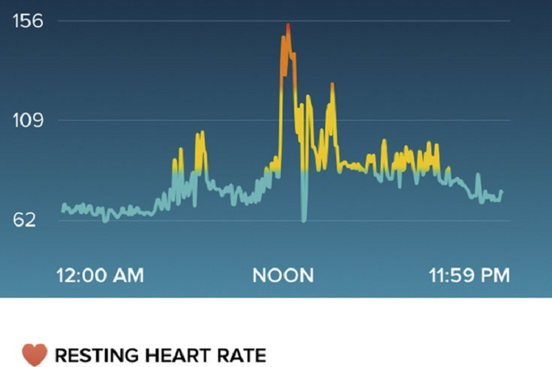 Fitbit: Virtual έρευνα για τη διάγνωση της καρδιακής αρρυθμίας 2 Fitbit: Virtual έρευνα για τη διάγνωση της καρδιακής αρρυθμίας