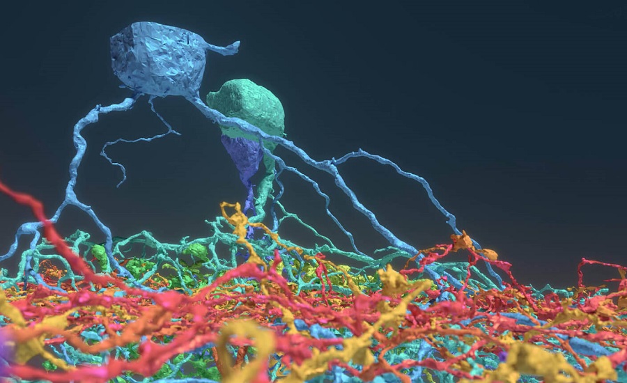 'Pioneering' gene therapy slows Huntington's disease 3 'Pioneering' gene therapy slows Huntington's disease