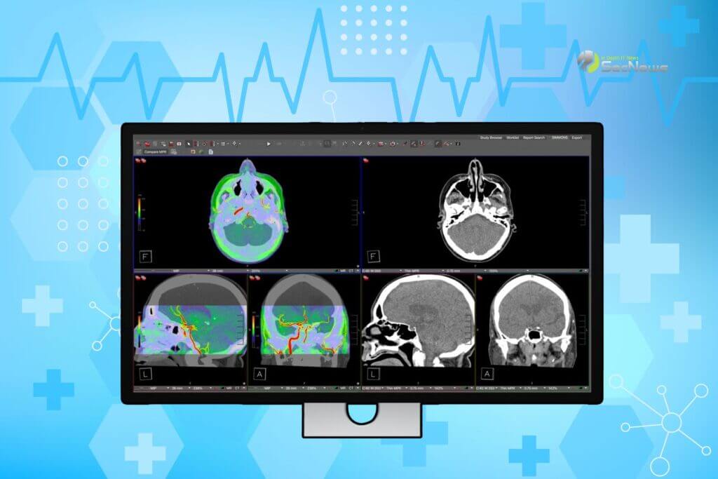 Η οθόνη Studio Display XDR της Apple υποστηρίζει DICOM Medical Imaging 1 Studio Display XDR